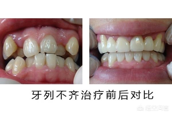 德宏最新24小时牙医在线咨询方法分析(最方便真实的德宏有没有24小时牙医方法)